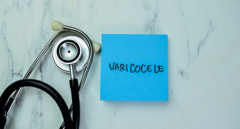 Quando il varicocele diventa pericoloso? Sintomi e rischi da non trascurare